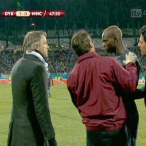 Mario Baloteli has allergic reaction in Manchester City v Dynamo Kiev