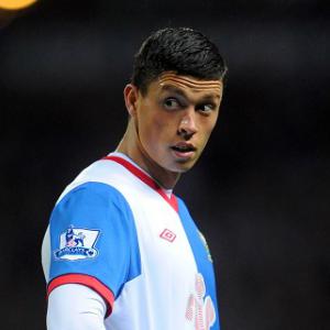 Black eye won't stop Lowe